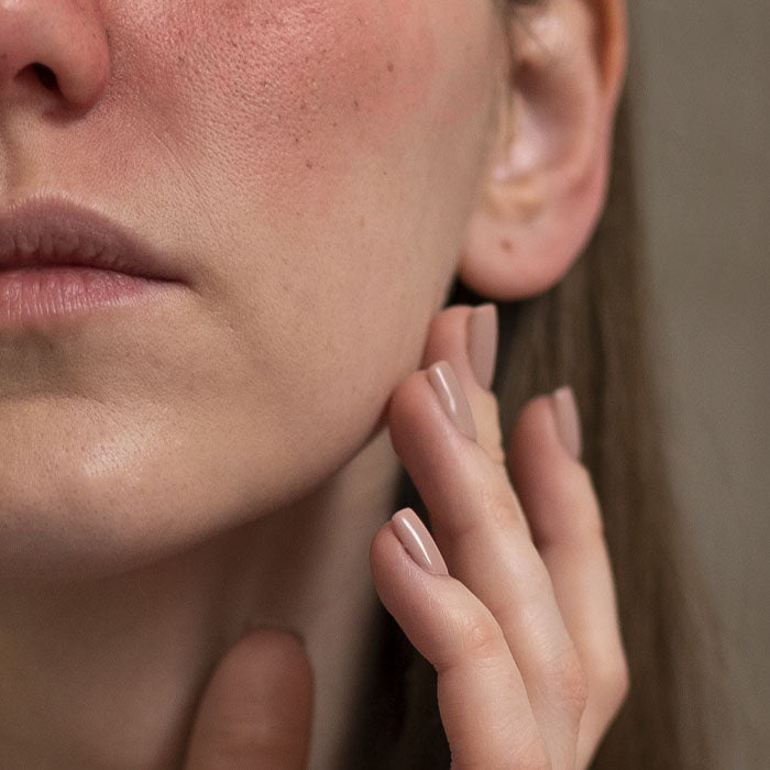 Liver Rosacea Bundle